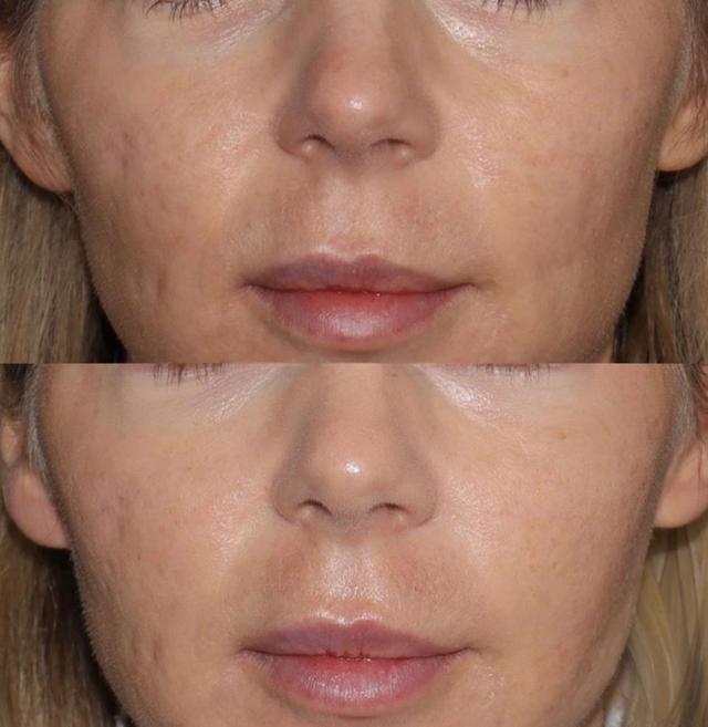 Before and after cosmetic treatment by Dr. Danny Guo