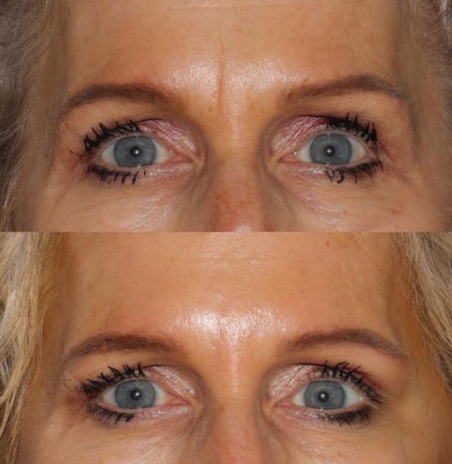 Before and after cosmetic treatment by Dr. Danny Guo