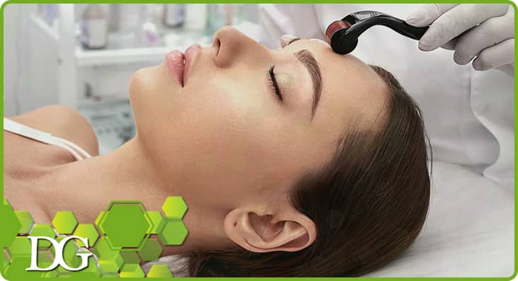 How Microneedling Improves Your Skin